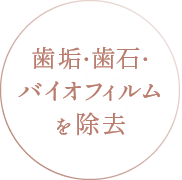 歯垢・歯石・バイオフィルムを除去