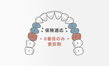 保険適応 6番目のみ要診断