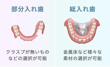 部分入れ歯（クラスプが無いものなどの選択が可能）総入れ歯（金属床など様々な素材の選択が可能）