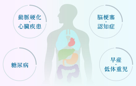 動脈硬化・心臓疾患、脳梗塞・認知症、糖尿病、早産・低体重児